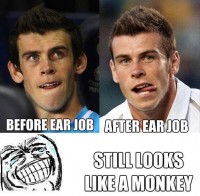 Before and After - Gareth Bale